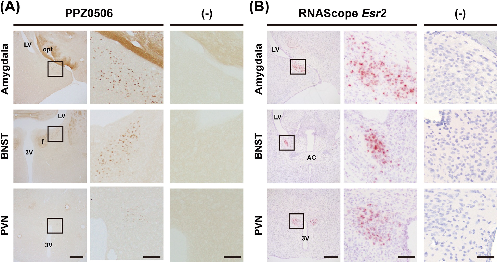 Optimized Mouse-on-mouse Immunohistochemical Detection of Mouse ESR2 Proteins with PPZ0506 Monoclonal Antibody