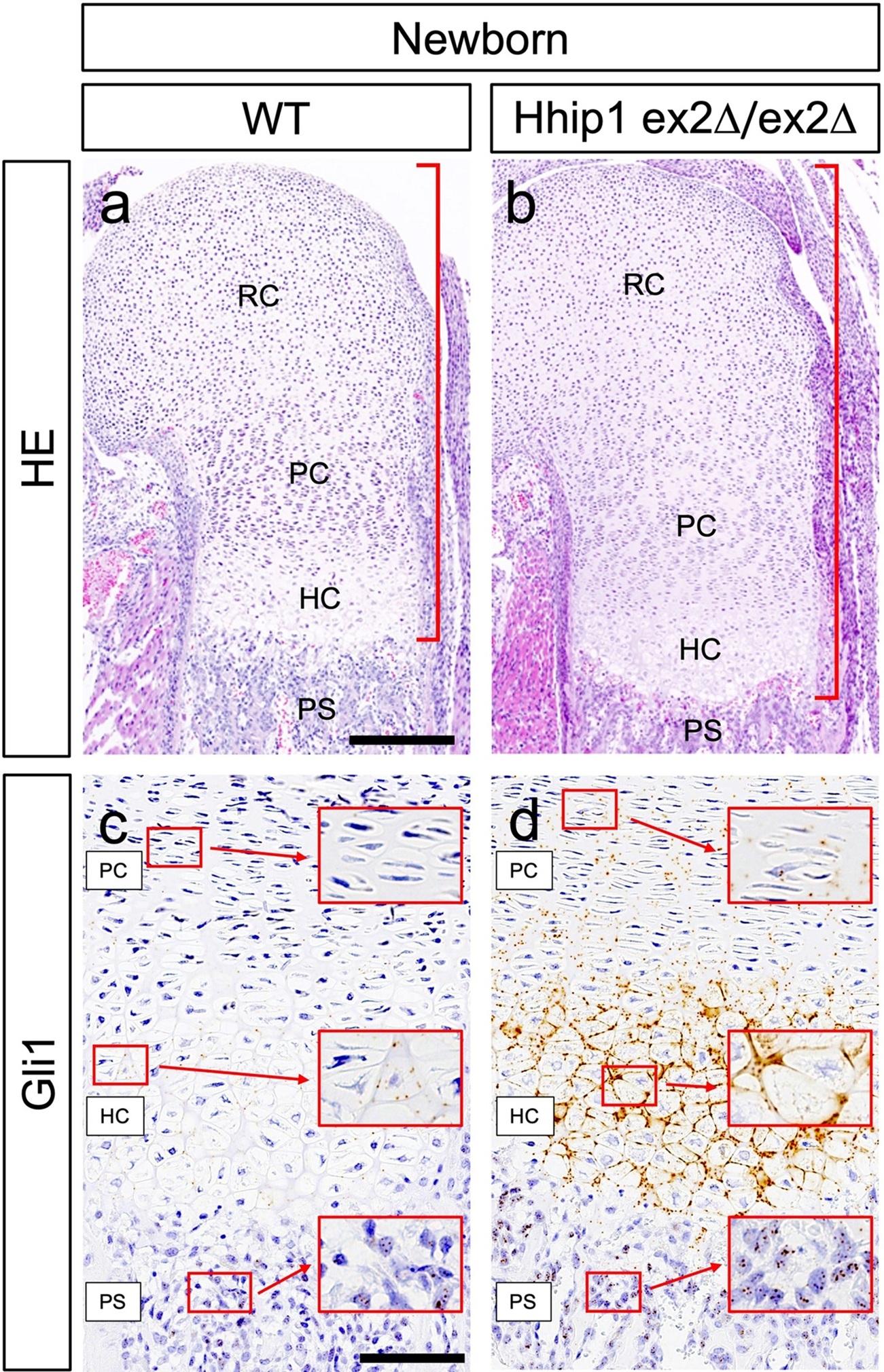 Dissecting Hhip1 Function <i>In Vivo</i> Using a Conditional Knockout Mouse Model