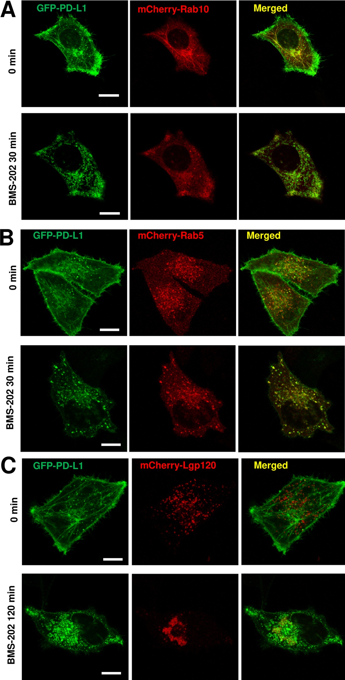 Intracellular Localization of PD-L1 in Rab10-positive Open Tubular Endosome System of Cancer Cells